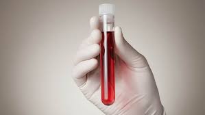 Abramge promove live sobre efetividade dos novos tratamentos hematológicos