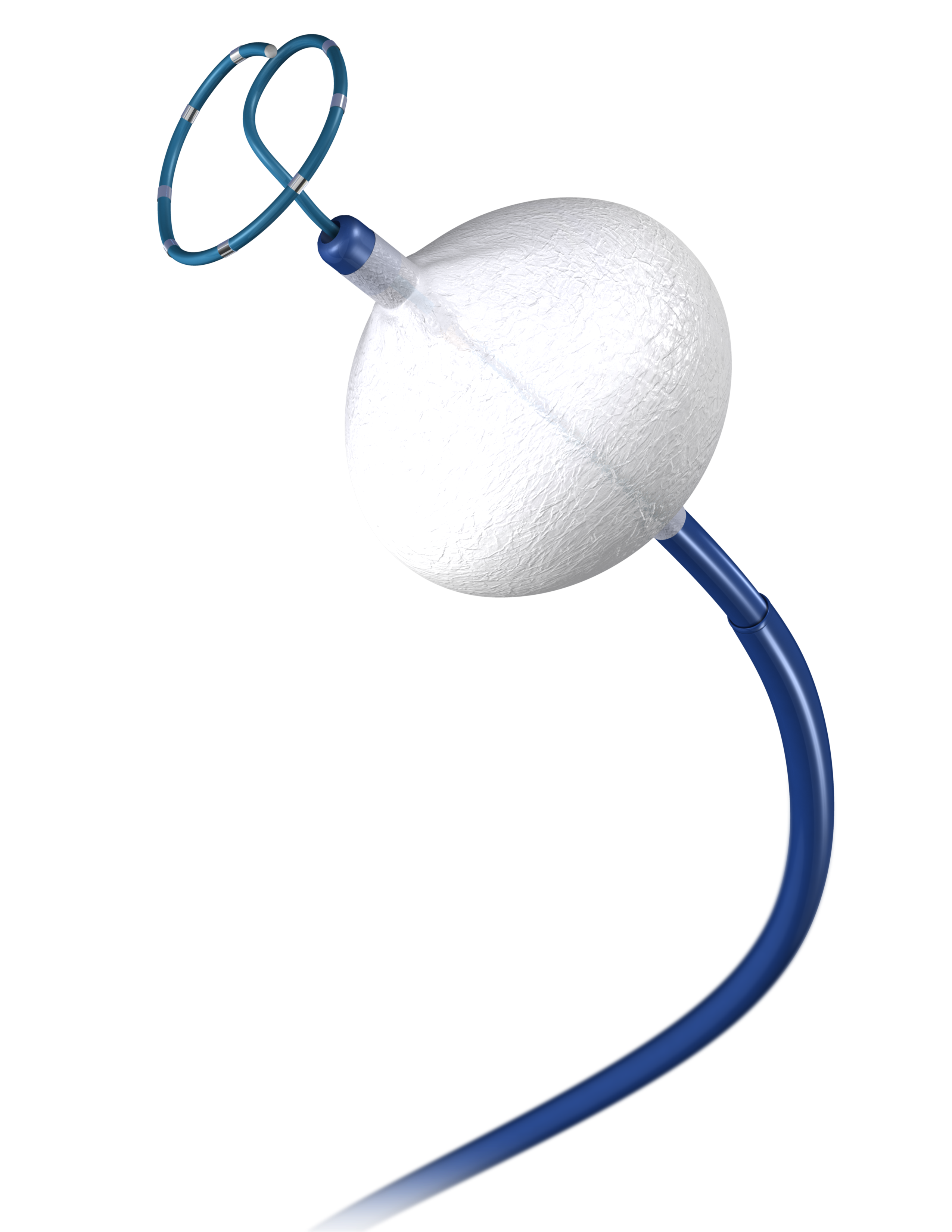 Crioablação, incorporada na ANS, se mostra mais eficaz e tem menor curva de aprendizado para hospitais