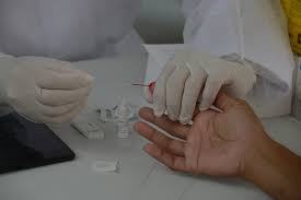 Testagem rápida para Covid e Influenza em trabalho presencial é recomendada pelo Ministério do Trabalho e Previdência