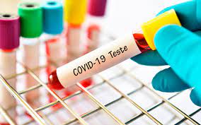 Número de exames de Covid nos laboratórios triplica. Taxa de positividade eleva 400%