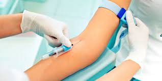 Testes de detecção precoce de múltiplos cânceres: um simples exame de sangue tem o potencial de revolucionar o rastreamento do tumor